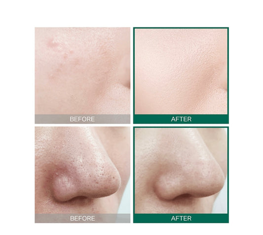 تونر العناية AHA BHA PHA من سوم باي مي - 150مل