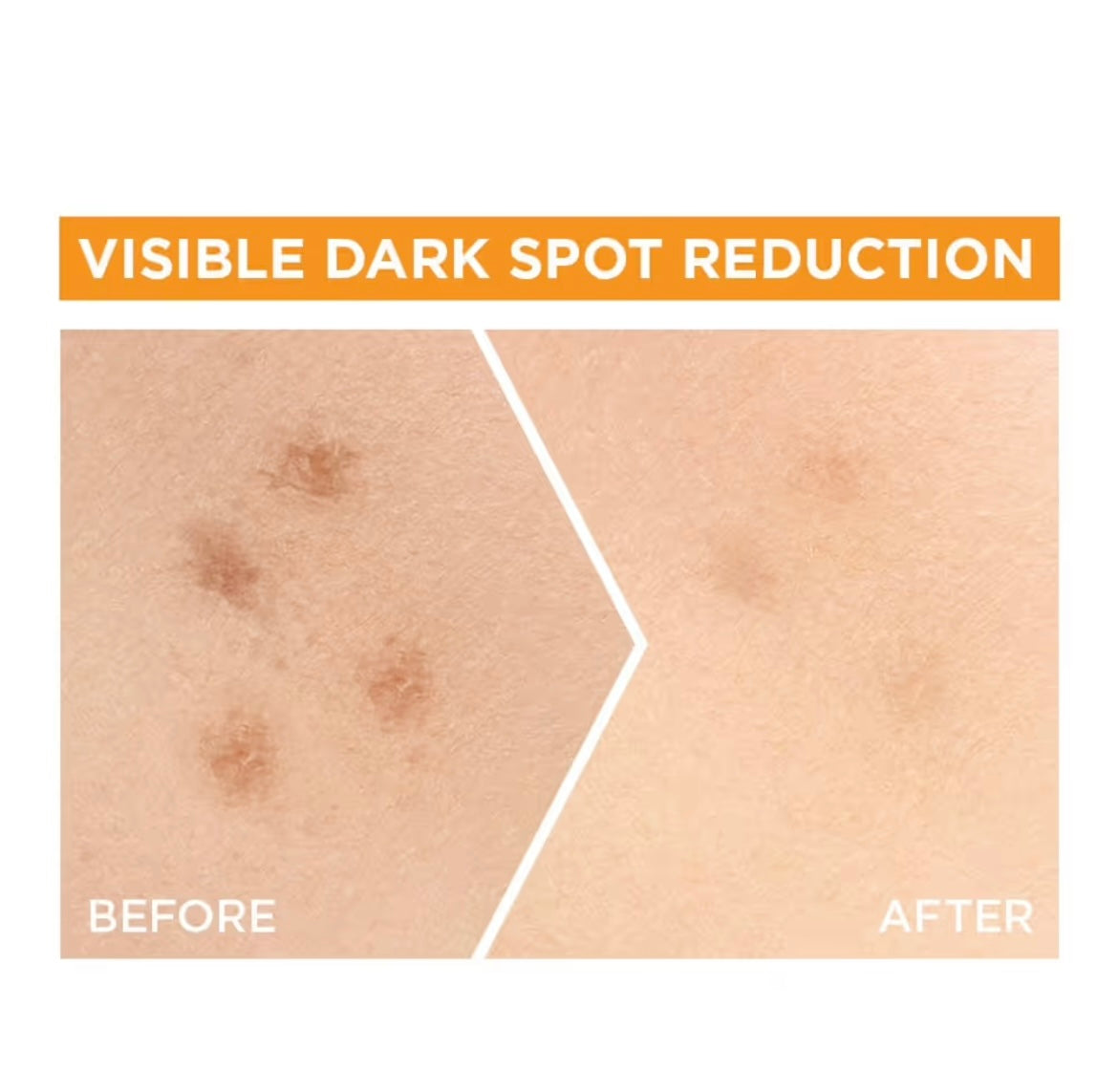 غارنييه سيروم للوجه سكين اكتيف إشراقة سريعة
فيتامين سي - 30 مل